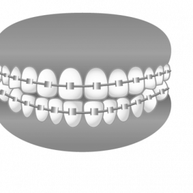 歯8
